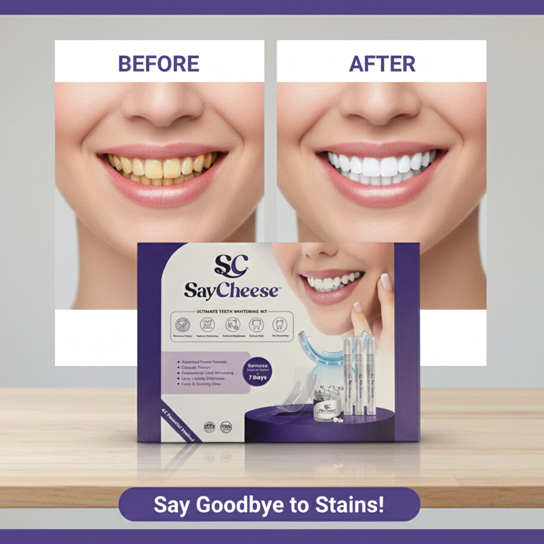 SayCheese™ Premium Whitening Kit — Non-Sensitive Smile Edition (HP/CP)