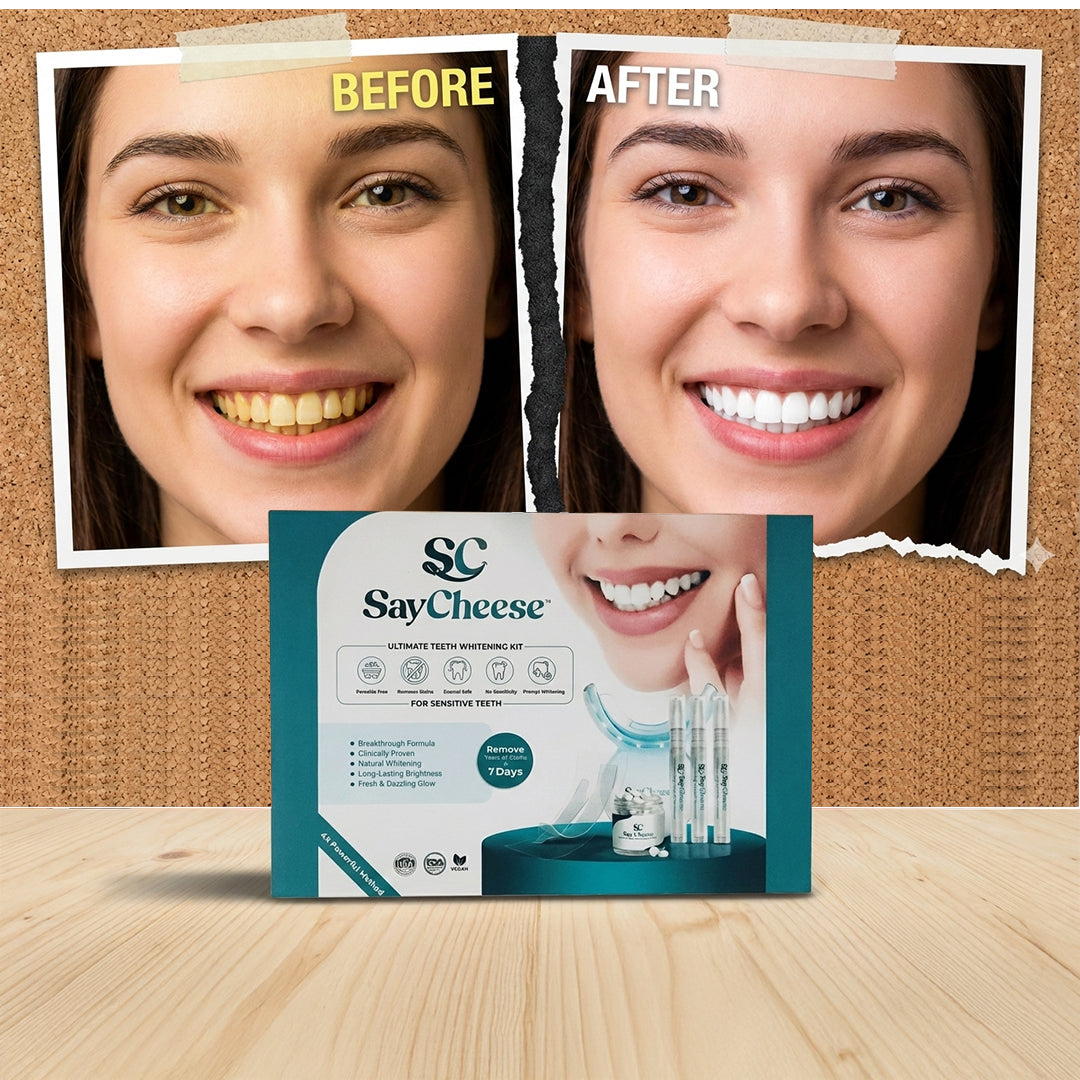 SayCheese™ Premium Whitening Kit — Sensitive Smile Edition (PAP+)