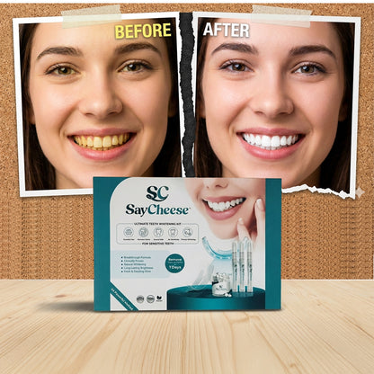 SayCheese™ Premium Whitening Kit — Sensitive Smile Edition (PAP+)